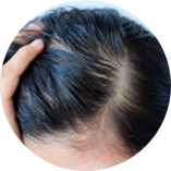 頭皮容易發癢或出油